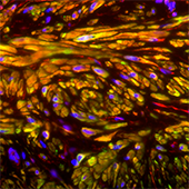 Microscopic image of regenerating bladder tissue